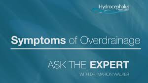 Ask The Expert Episode 3 Symptoms Of Overdrainage Youtube
