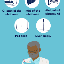 When cancer originates in one or both testes, a man can go a long time without any obvious signs or symptoms. How Lung Cancer Spreads To The Liver
