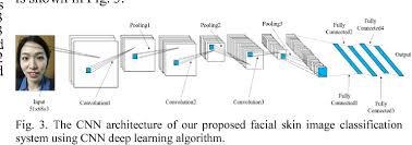 The noisy cnn algorithm finds a special separating hyperplane in the network's noise space. Figure 3 From Facial Skin Image Classification System Using Convolutional Neural Networks Deep Learning Algorithm Semantic Scholar