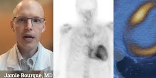 New ASNC quality metrics will support standardization of imaging for  cardiac amyloidosis