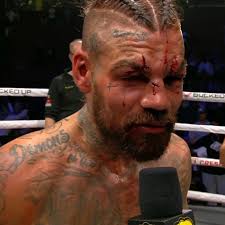 Judges need to wise up': Goodjohn reacts to BKFC 42 loss to Tony Soto