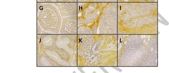 I dispositivi si attivano con la rete nervosa presente sulla pelle e veicolano segnali elettromagnetici a bassissima frequenza (elf) ed intensità per migliorare il trasporto di ossigeno in tutto il corpo. Tincion Inmunohistoquimica Para El Cs En Tnes A D G J Tejido Sano Download Scientific Diagram
