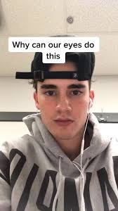 Understanding Crossed Eyes: Exploring the Beauty of Eye Movement