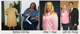 Following a gastric bypass upper part of the stomach is divided into a smaller section. Before After Pictures Testimonials Gastric Bypass Before After Testimonials After Obesity Surgery San Francisco California