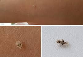 În ciuda zilelor ploioase din ultima vreme, se pare că insecta care a terorizat vara trecută capitala și împrejurimile a revenit. Mare AtenÅ£ie IatÄƒ Ce Este De Fapt Tigrul De Platan Insecta Care TerorizeazÄƒ Romania