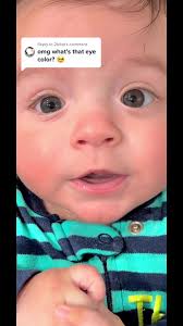 Rare Condition: Heterochromia in Babies