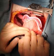 Download transparent real heart png for free on pngkey.com. Heart Surgery Residents Ready To Save Real Lives After Out Of Body Training Experience