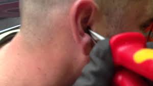 Ear Plug Stuck In Ear Youtube