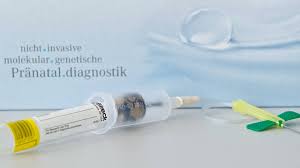 Bluttest Auf Down Syndrom Mehr Abtreibungen Befurchtet