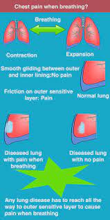 Pin On Symptoms And Diagnosis Project
