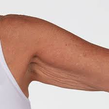 I walk 30 minutes daily and sometimes i swim in an indoor pool at my gym. What Is Crepey Skin How To Get Rid Of It Crepe Erase