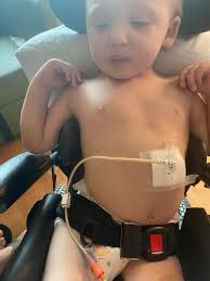 His recovery is going to be at a snail's pace. 😊🐌