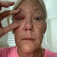 THE BEST 10 Optometrists in SANIBEL ISLAND, FL