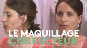 Maladies rares de la peau et des muqueuses d'origine génétique (MAGEC)