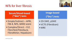 Image result for BARD Score