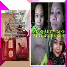 Video by yan oyien vsl beauty care 1. Testimoni Vsl Beauty Care By Dealer Vsl Beauty Care Hq Facebook