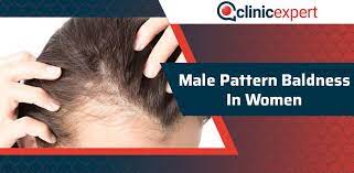 Sometimes hair loss can occur because your hair is being pulled on too much. Male Pattern Baldness In Women