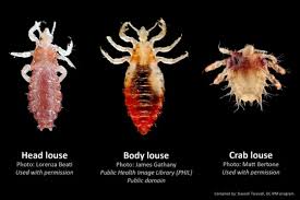 Image result for pubic lice symptoms