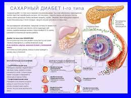 Sestrinskij Process Pri Saharnom Diabete U Detej Online Presentation