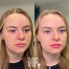 Kyndra Thomas, MSN, APRN (@nofilternp.kyndra) • Instagram photos and videos