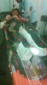 إصابة طفل بجروح خطيرة إثر انفجار بقايا مقذوف متفجر وسط منطقة حجر