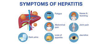 Image result for hepatitis symptoms