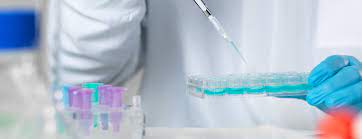 Carrier Testing For Fragile X Syndrome Ucsf Health