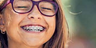 Bunte zahnspange glänzende zahnpfanne vergoldung zähne dekoration zähne zubehör. Elternratgeber Zahnspange Wer Tragt Die Kosten Und Was Ist Zu Beachten