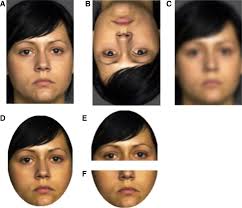 Identifying Mental Disorder from the Faces of Women with Borderline  Personality Disorder
