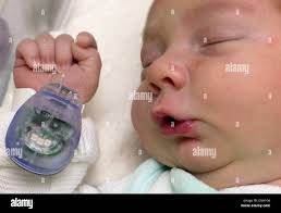 Hospital baby germany hi-res stock photography and images