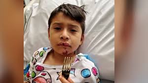 Elgin boy struck by 18-wheeler