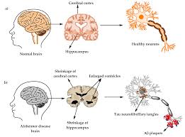 Tpi televisi pendidikan indonesia mengudara 23 januari 1991| hari ini dalam sejarah. Molecules Free Full Text Comprehensive Review On Alzheimer S Disease Causes And Treatment Html