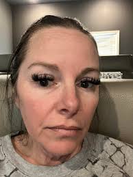 Hi I was wondering if anyone else is taking plaqueneil, mycophenalate and  ACTEMRA. Does it seem to helping y'all?