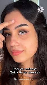 Diy pimple hack!, @bronzedbisma