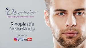 Rinoplastia femenina y masculina