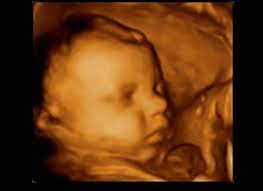 28 haftalık bebek görüntüsü nasıldır? Gebelikte 30 Hafta Gebe Com