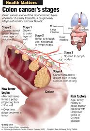 Colon cancer in young guys is rare. Tck The Colon King Health Bits By Tck The Colon King Knowledge Is Power Lamang Ang May Alam Know More About Colorectal Cancers Your Digestive System Plays A Critical Role