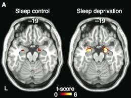 This Is What Happens To Your Brain When You Don T Get Enough Sleep Lack Of Sleep Sleep Deprivation Sleep