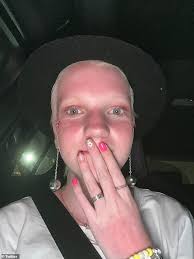 16-year-old Taylor Swift fan who was gifted the singer's '22' hat