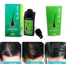 (10) spikenard oil is known for promoting the growth of hair and slowing down the graying process of graying. Buy Pack Of 2 Hot Seller Neo Hair Lotion Herbs 100 Natural Treatment Spray Stop Hair Loss Root Nutrients 4 2 Oz 120 Ml Online In Vietnam B08298xlfw