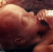 Man kann zwar schon vorher ein baby „sitzen lassen mit ausreichender stütze, das ist aber nicht sinnvoll und schadet sogar dem rücken. Gesundheit Wie Sauglinge Mit Herzfehlern Uberleben Konnen Welt