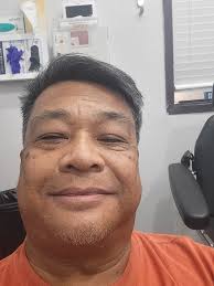 Bionic Smile Team Patient Experience with Surgery and Permanent Installation