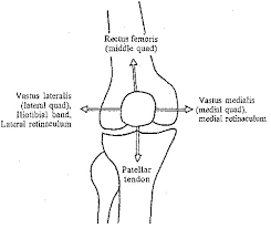 Patellofemoral Pain Syndrome In The Female Athlete Clinics In Sports Medicine