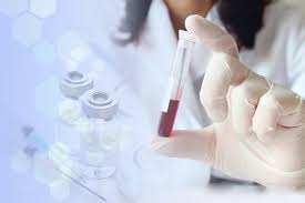 Fibromyalgia can affect people of both genders and all ages. Fibromyalgia Blood Test From Epicgenetics Now Available In Canada