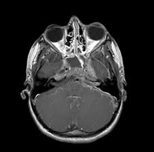 Image result for artistic divergence eyeballs