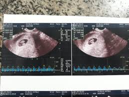 Metodo Ramzi Alguem Intendi Marco De 2020 Babycenter