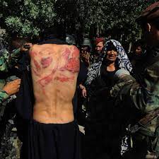 We did not find results for: Afghanistan Taliban Hacken Vermeintlichem Dieb Hand Und Fuss Ab Der Spiegel