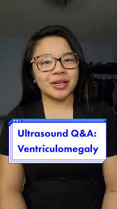 Replying to @sara.itzel.gutierrez Ventriculomegaly