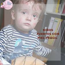 🦋 25 de Octubre Día Mundial de la Epidermolisis Ampollar 🦋 También  llamada PIEL de Cristal o piel de Mariposa 🦋Es una enfermedad genetica  rara, poco frecuente, no contagiosa 🦋Se caracteriza por