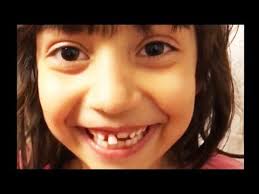 Funniest Lost Tooth Party Fails Compilation 2019 Youtube Party Fail Tooth Pulled Teeth